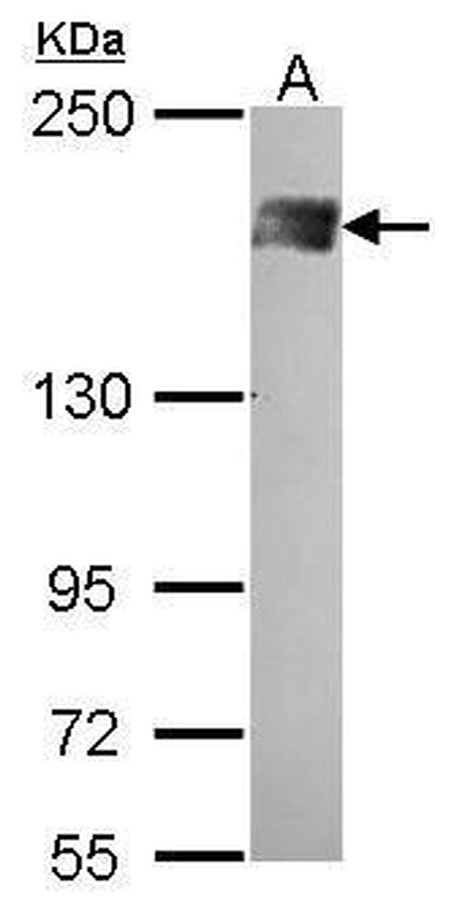 PBRM1 Antibody in Western Blot (WB)