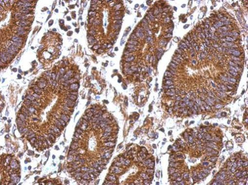 Laminin beta-1 Antibody in Immunohistochemistry (Paraffin) (IHC (P))