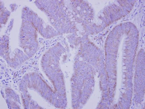 CD51 Antibody in Immunohistochemistry (Paraffin) (IHC (P))