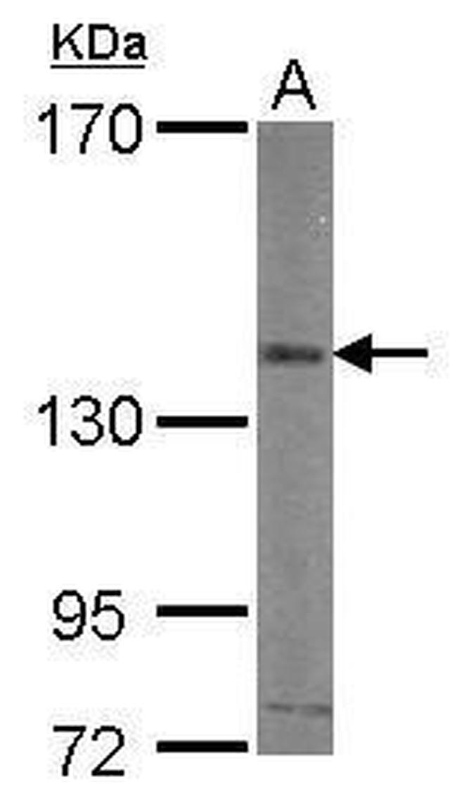 CD51 Antibody in Western Blot (WB)