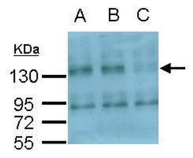 CD51 Antibody in Western Blot (WB)