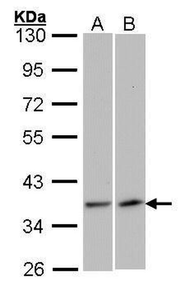 VEGFD Antibody in Western Blot (WB)