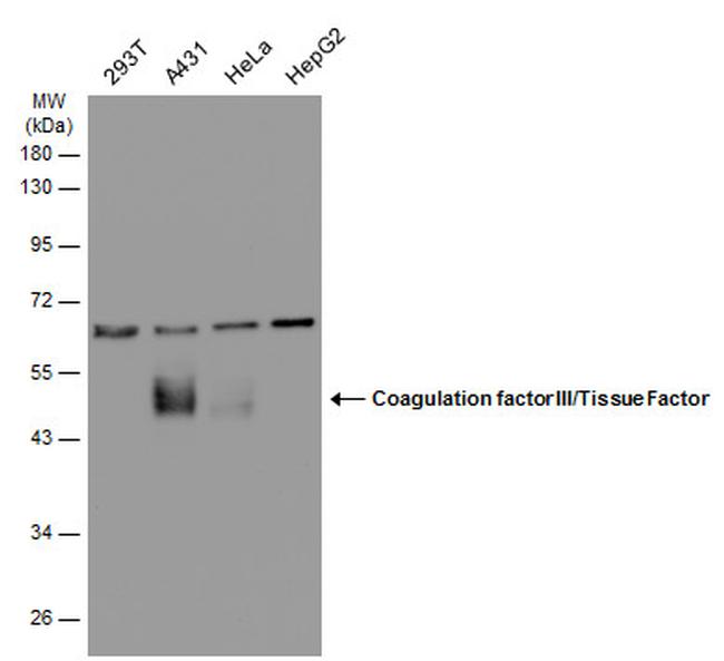 CD142 Antibody in Western Blot (WB)