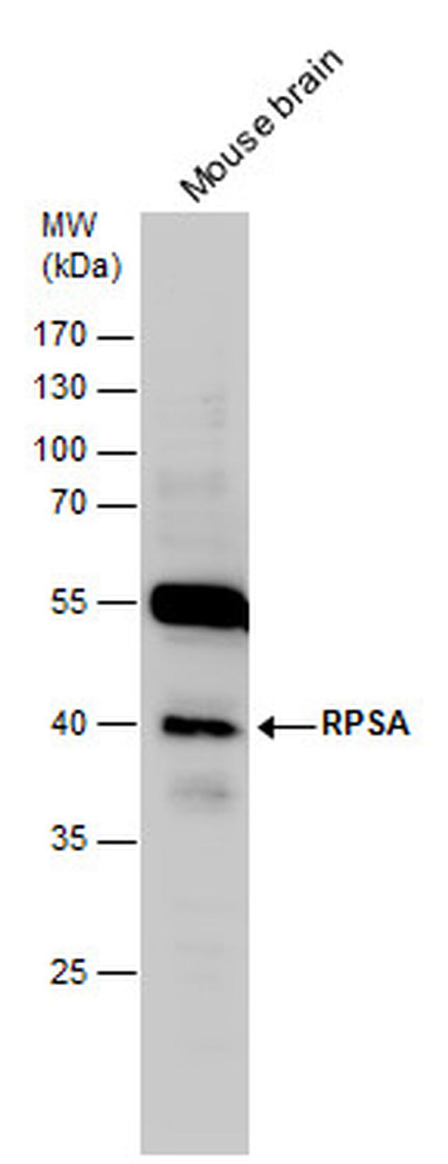 RPSA Antibody in Western Blot (WB)