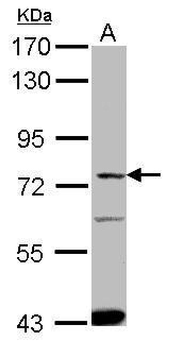 SLC27A4 Antibody in Western Blot (WB)