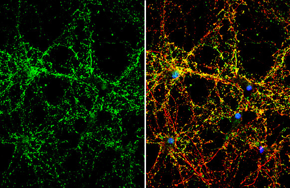 Synaptophysin Antibody in Immunocytochemistry (ICC/IF)