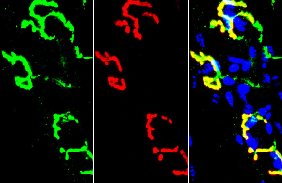 Synaptophysin Antibody in Immunohistochemistry (Frozen) (IHC (F))