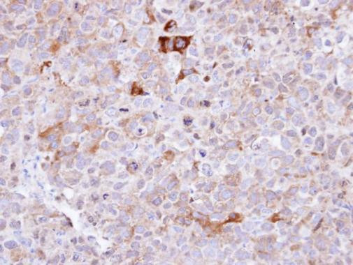 Synaptophysin Antibody in Immunohistochemistry (Paraffin) (IHC (P))