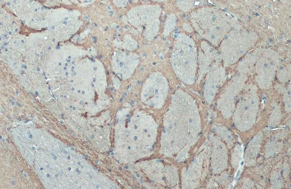 Synaptophysin Antibody in Immunohistochemistry (Paraffin) (IHC (P))