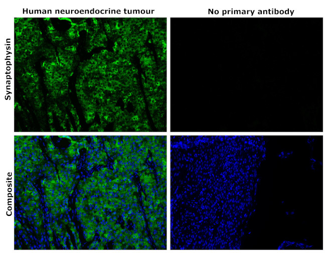 Synaptophysin Antibody in Immunohistochemistry (Paraffin) (IHC (P))