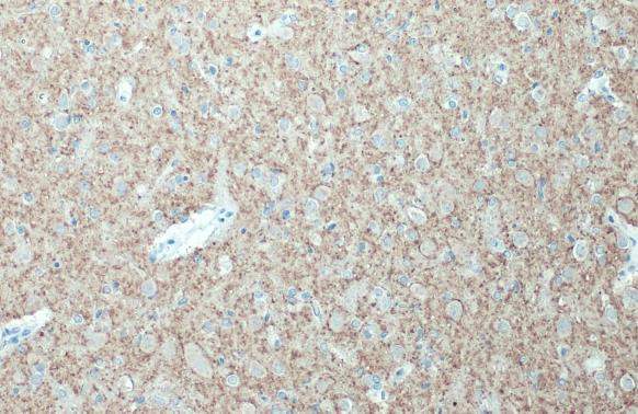 Synaptophysin Antibody in Immunohistochemistry (Paraffin) (IHC (P))