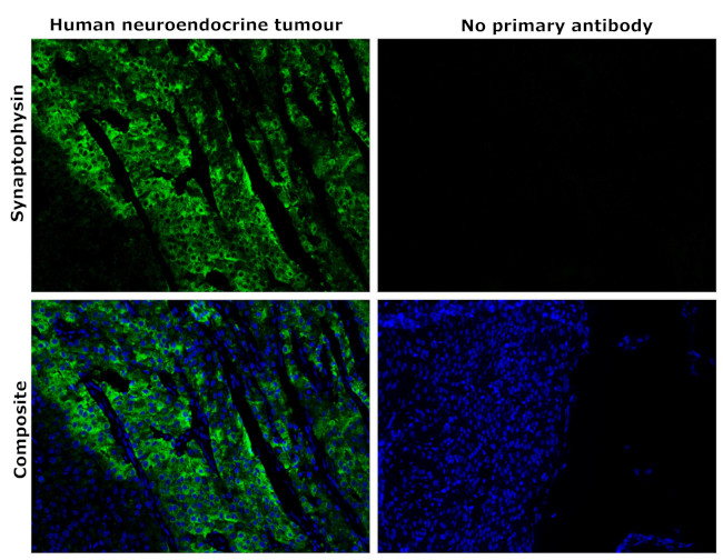 Synaptophysin Antibody in Immunohistochemistry (Paraffin) (IHC (P))