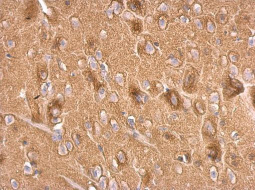 Synaptophysin Antibody in Immunohistochemistry (Paraffin) (IHC (P))