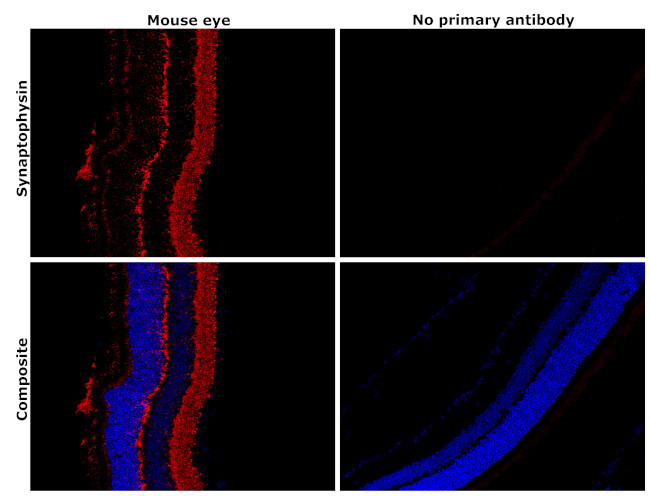 Synaptophysin Antibody in Immunohistochemistry (Paraffin) (IHC (P))