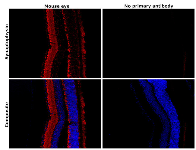 Synaptophysin Antibody in Immunohistochemistry (Paraffin) (IHC (P))