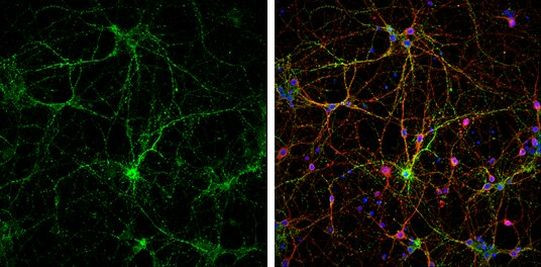 Synaptophysin Antibody in Immunocytochemistry (ICC/IF)