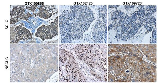 Synaptophysin Antibody in Immunohistochemistry (Paraffin) (IHC (P))