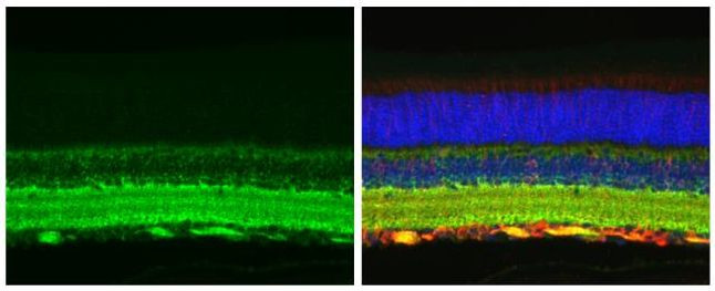 Tau Antibody in Immunohistochemistry (Paraffin) (IHC (P))