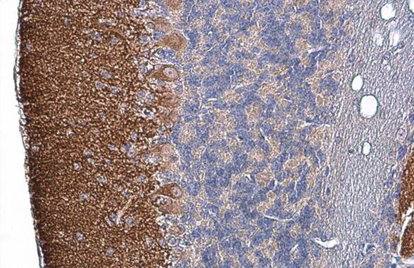 Tau Antibody in Immunohistochemistry (Paraffin) (IHC (P))