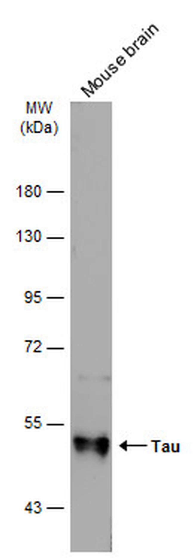 Tau Antibody in Western Blot (WB)