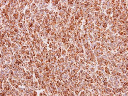 BMP-4 Antibody in Immunohistochemistry (Paraffin) (IHC (P))