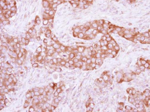 PKLR Antibody in Immunohistochemistry (Paraffin) (IHC (P))