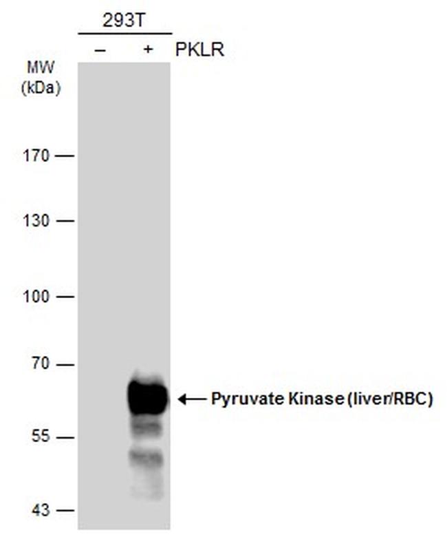 PKLR Antibody in Western Blot (WB)