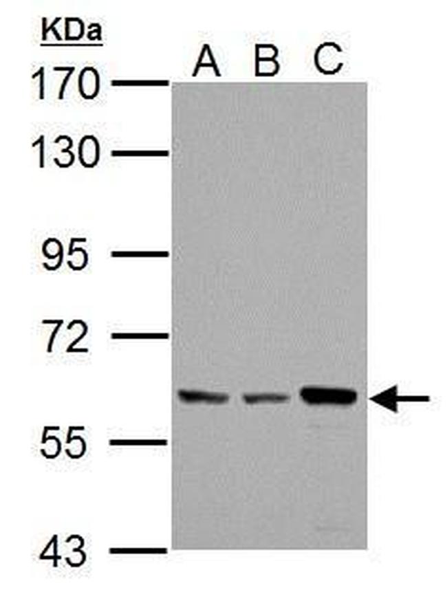 PKLR Antibody in Western Blot (WB)