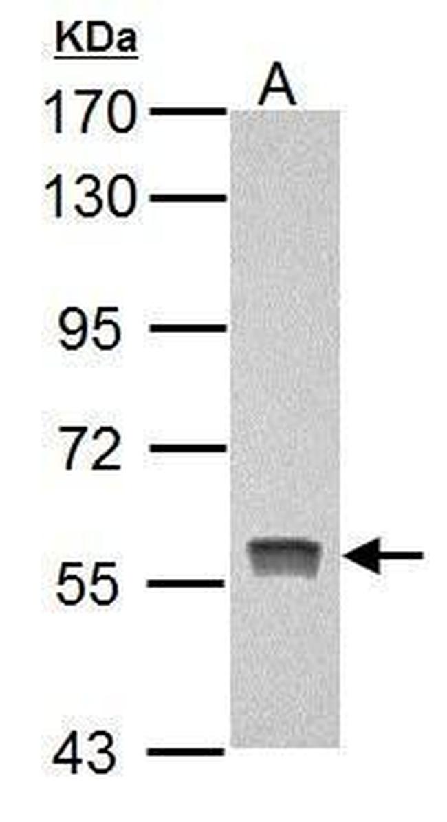 PKLR Antibody in Western Blot (WB)