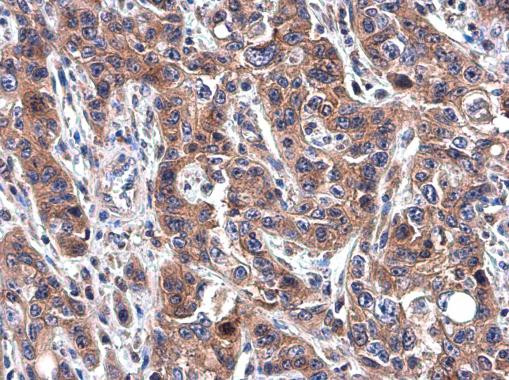 Transferrin Antibody in Immunohistochemistry (Paraffin) (IHC (P))