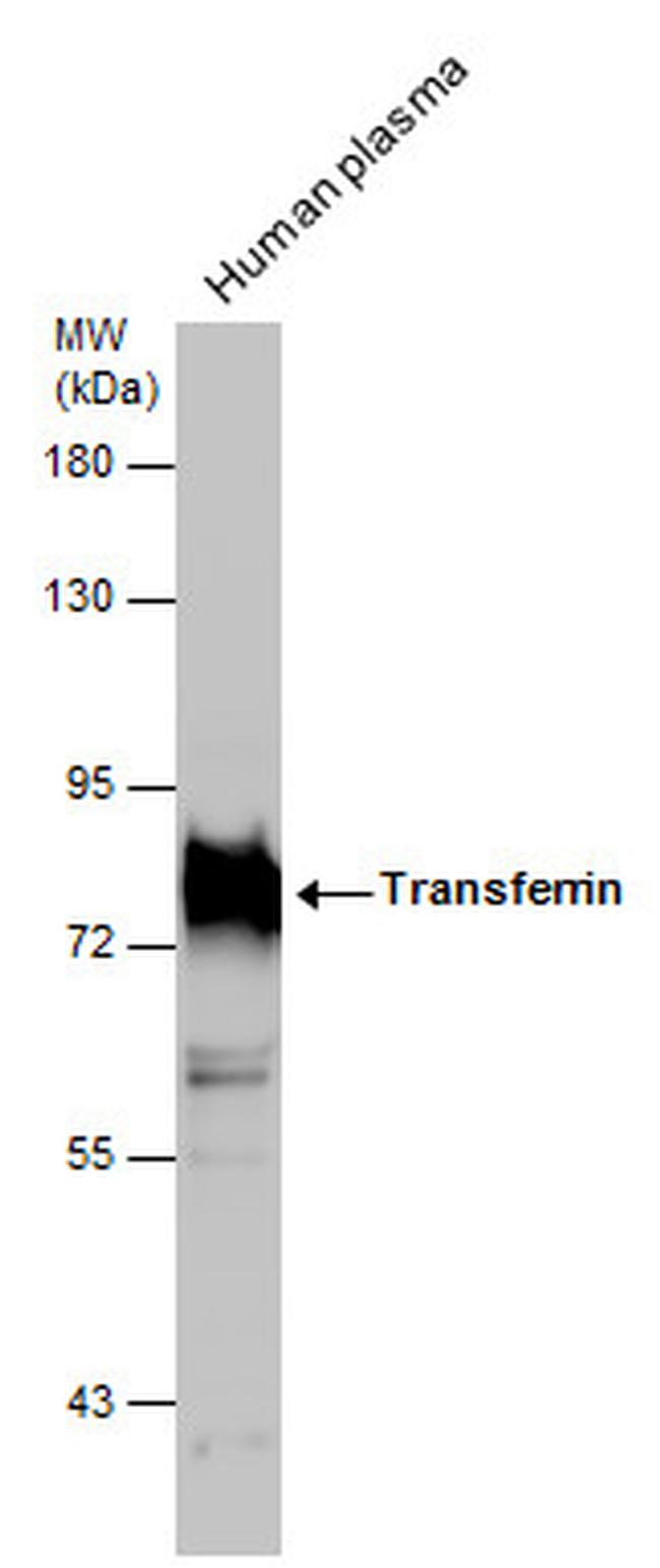 Transferrin Antibody in Western Blot (WB)