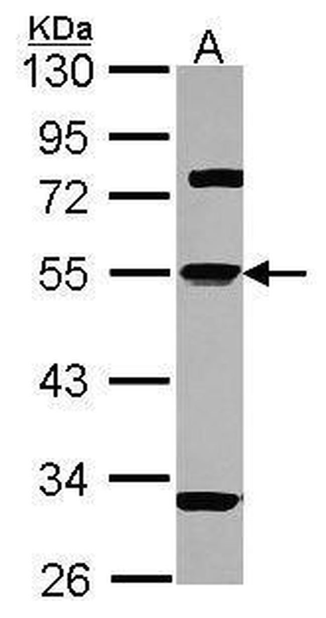 alpha-1 Antitrypsin Antibody in Western Blot (WB)