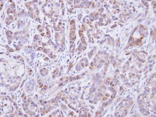 SHP2 Antibody in Immunohistochemistry (Paraffin) (IHC (P))