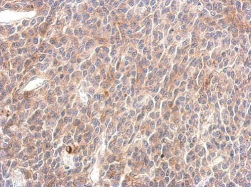 SHP2 Antibody in Immunohistochemistry (Paraffin) (IHC (P))