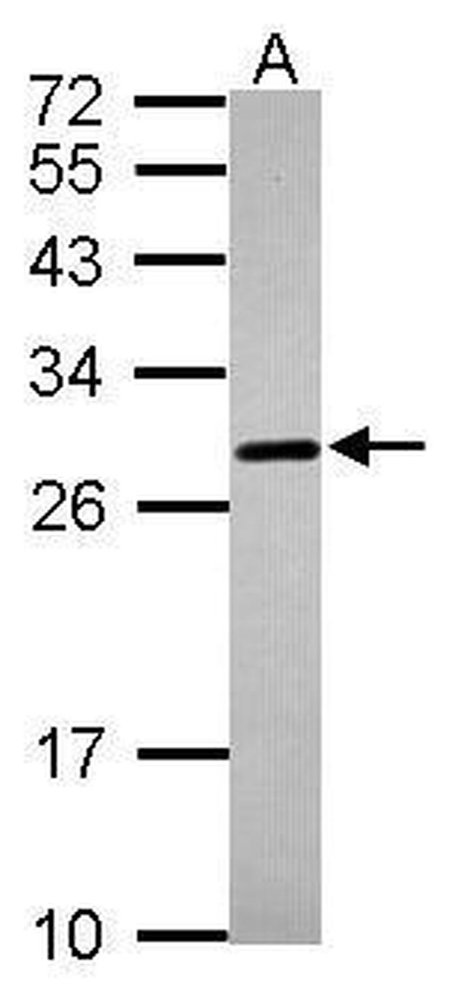 PrP Antibody in Western Blot (WB)