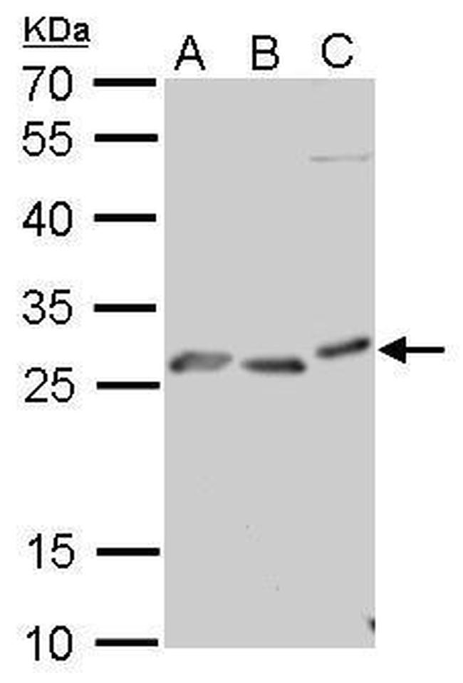 PrP Antibody in Western Blot (WB)