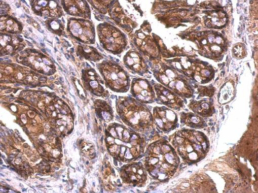 14-3-3 zeta Antibody in Immunohistochemistry (Paraffin) (IHC (P))