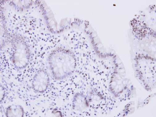 WRN Antibody in Immunohistochemistry (Paraffin) (IHC (P))