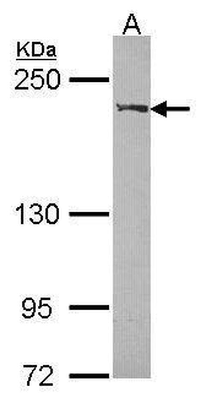 WRN Antibody in Western Blot (WB)