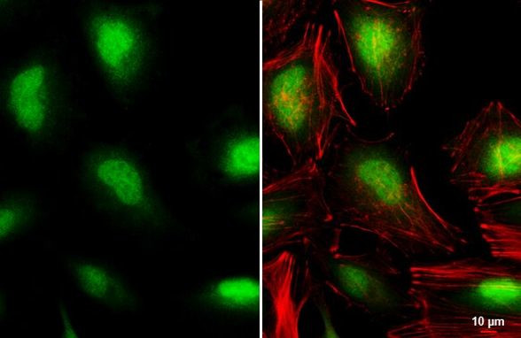 VHL Antibody in Immunocytochemistry (ICC/IF)