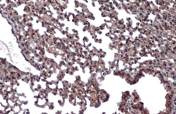 VHL Antibody in Immunohistochemistry (Paraffin) (IHC (P))