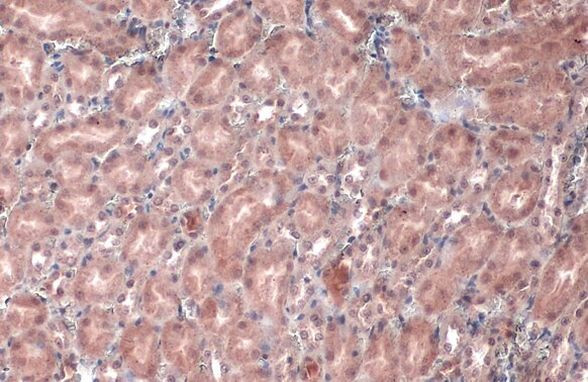 VHL Antibody in Immunohistochemistry (Paraffin) (IHC (P))