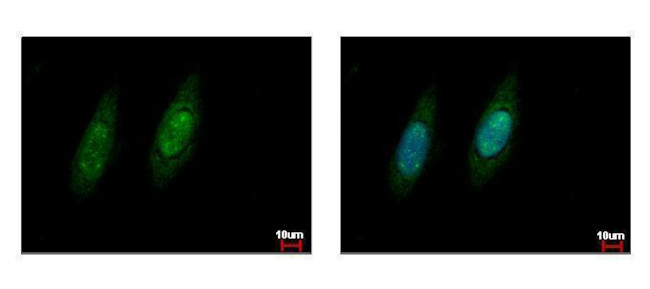 VCP Antibody in Immunocytochemistry (ICC/IF)