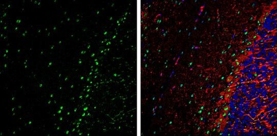 VCP Antibody in Immunohistochemistry (Frozen) (IHC (F))