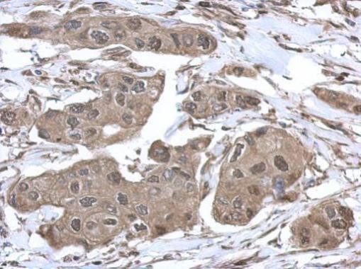 VCP Antibody in Immunohistochemistry (Paraffin) (IHC (P))