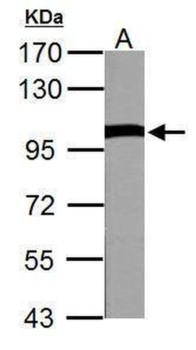 VCP Antibody in Western Blot (WB)