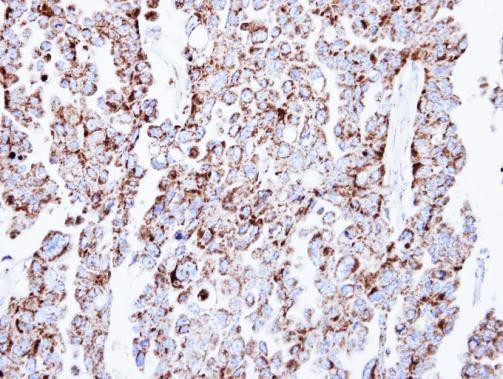 Prohibitin Antibody in Immunohistochemistry (Paraffin) (IHC (P))