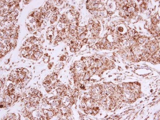 Prohibitin Antibody in Immunohistochemistry (Paraffin) (IHC (P))