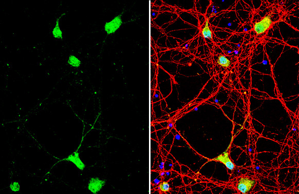 NRG1 Antibody in Immunocytochemistry (ICC/IF)