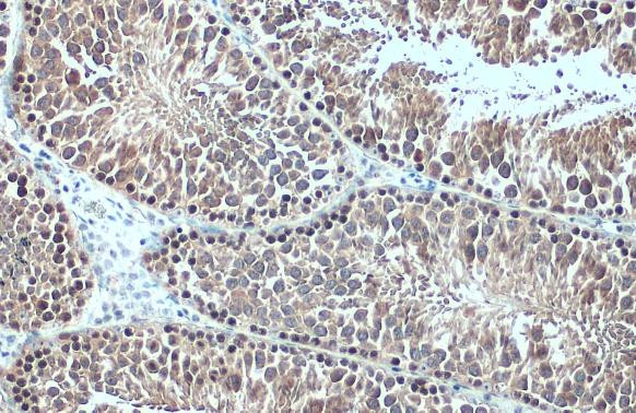 HSC70 Antibody in Immunohistochemistry (Paraffin) (IHC (P))